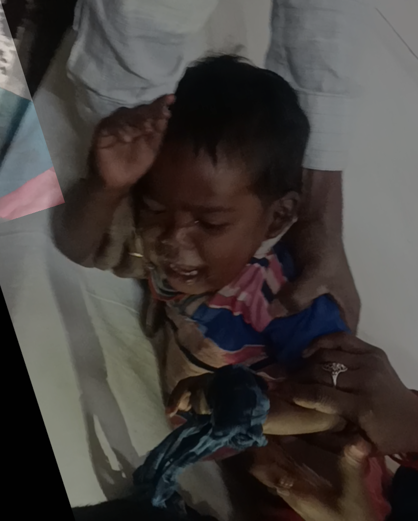 रुदौली: लोहानी का पुरवा गांव में दो वर्ष के बच्ची के वाए हाथ के पंजे पर भैंस के पैर रखने से उंगली कटी